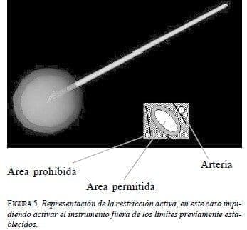 Sistema da Vinci: Representación de la restricción activa Sistema da Vinci: Representación de la restricción activa