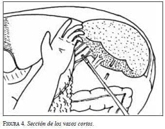 Sección de los Vasos Cortos Sección de los Vasos Cortos