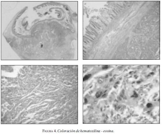 Coloración de hematoxilina - eosina  Coloración de hematoxilina - eosina