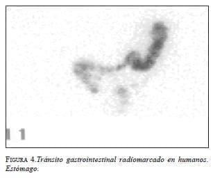 Tránsito gastrointestinal radiomarcado en humanos. Estómago.