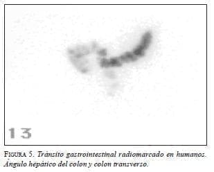 Tránsito gastrointestinal radiomarcado en humanos. Ángulo hepático