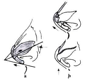 El Concepto de Trípode El Concepto de Trípode