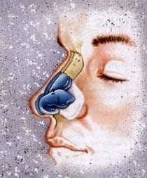 Soporte menores de la punta nasal