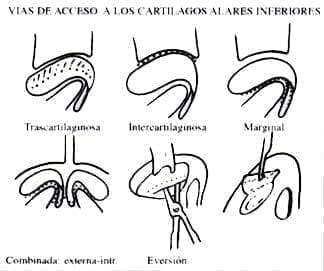 Vías endonasales Vías endonasales