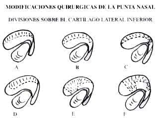 Modificaciones Quirúrgicas Modificaciones Quirúrgicas