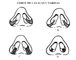 Base y las Ventanas Nasales