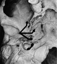 Desórdenes inflamatorios