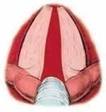 Formación de tejido cicatrizal