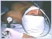 Regulador de Sandler