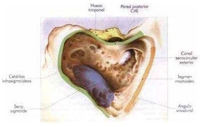 Celdillas mastoideas