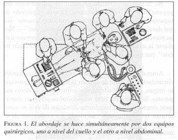 Hipofaringe y el Esófago Cervical, equipos quirúrgicos