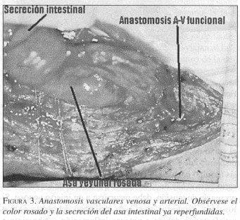 Anastomosis Vasculares Venosa y Arterial Anastomosis Vasculares Venosa y Arterial