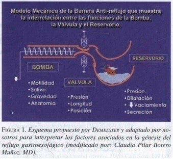 Esquema propuesto por DEMEESTER