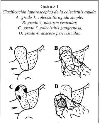 Clasificación Laparoscópica de la Colecistitis Aguda