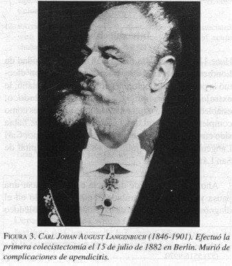 Carl Johan Langenbuch(1846-1901) Carl Johan Langenbuch(1846-1901)