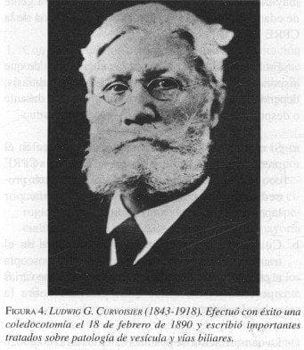 Ludwigg Curvoisier (1843-1918) Ludwigg Curvoisier (1843-1918)