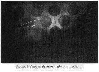 Imagen de Marcación por Arpón