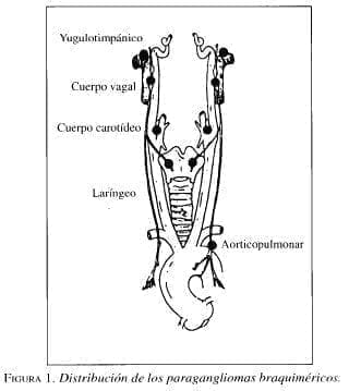 Distrihución de los Paragangliomas Braquiméricos