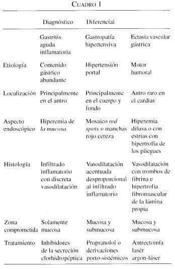 Gastritis Aguda Inflamatoria y la Gastropatía Hipertensiva