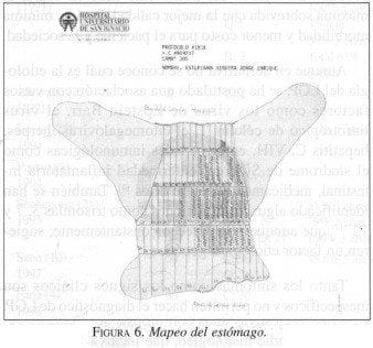 Mapeo del estómago Mapeo del estómago