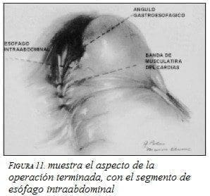 Aspecto de la Operación Terminada Aspecto de la Operación Terminada