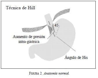 Técnica de Hill, Anatomía normal Técnica de Hill, Anatomía normal