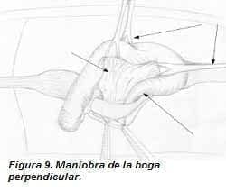 Maniobra de la Boga Perpendicular Maniobra de la Boga Perpendicular