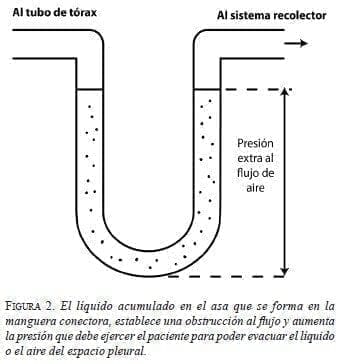 El líquido acumulado en el Asa que se forma en la Manguera Conectora