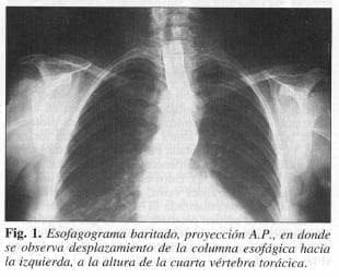 Desplazamiento columna