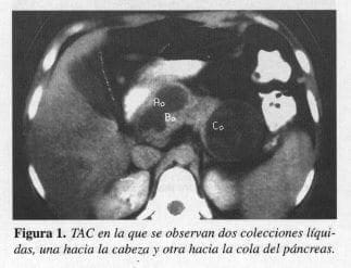 Dos Colecciones Líquidas
