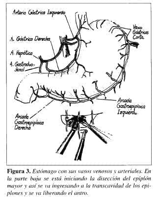 Estómago con sus Vasos Venosos y Arteriales Estómago con sus Vasos Venosos y Arteriales