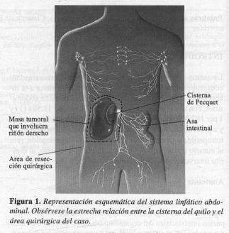 Sistema Linfático Abdominal