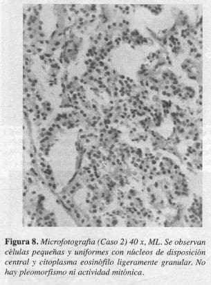 Disposición Central y Citoplasma Eosinófilo Ligeramente Granular