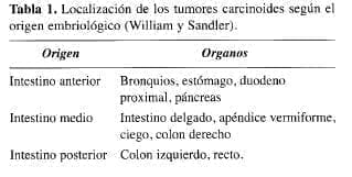 Localización de los Tumores Carcinoides Localización de los Tumores Carcinoides