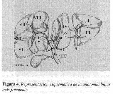Representación Esquemática de la Anatomía Biliar más frecuente Representación Esquemática de la Anatomía Biliar más frecuente