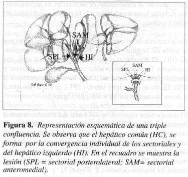 Representación Esquemática de una Triple Confluencia Representación Esquemática de una Triple Confluencia