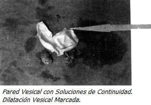 Pared Vesical con Soluciones de Continuidad Pared Vesical con Soluciones de Continuidad