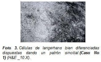 Células de langerhans