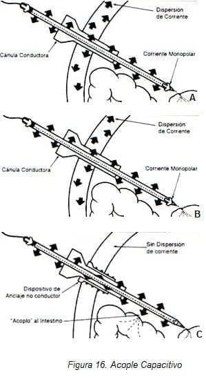 Endocirugía: Acople Capacitivo Endocirugía: Acople Capacitivo