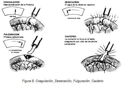Endocirugía: Coagulación, Desecación, Fulguración, Cauterio Endocirugía: Coagulación, Desecación, Fulguración, Cauterio