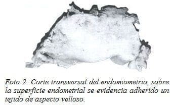 Tejido de Aspecto Velloso