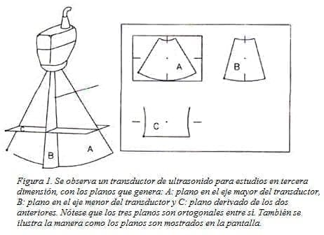 Transductor de Ultrasonido para Estudios en tercera Dimensión