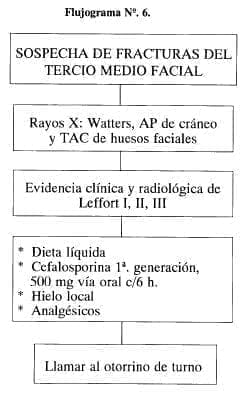 Sospecha de Fracturas del Tercio Medio Facial Sospecha de Fracturas del Tercio Medio Facial