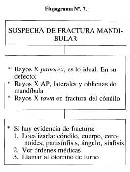 Sospecha de Fractura Mandibular Sospecha de Fractura Mandibular