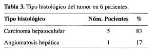 Tumores Primitivos del Hígado, Tipo histológico Tumores Primitivos del Hígado, Tipo histológico