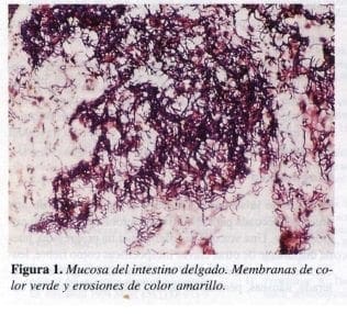 Mucosa del Intestino Delgado