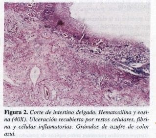Corte de intestino delgado. Hematoxilina y Eosina