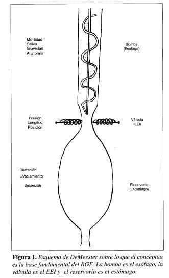 Esquema de DeMeester