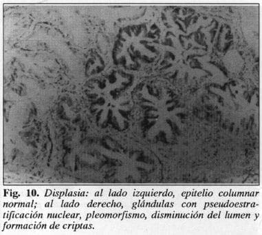 Epitelio Columnar Normal