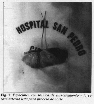 Espécimen con Técnica de Enrrollamiento